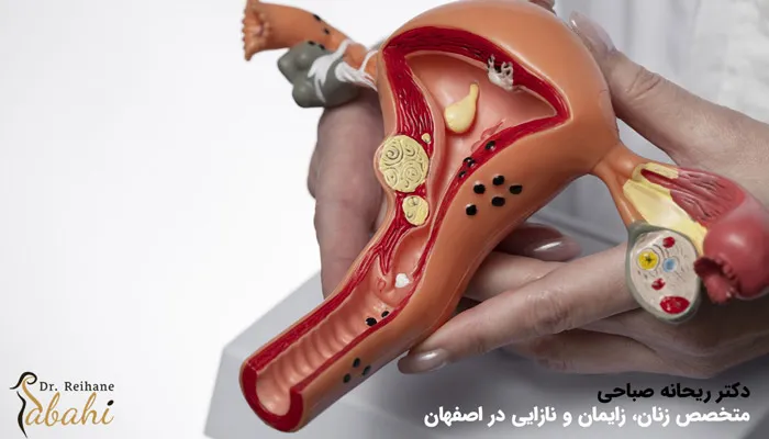 هزینه لاپاراسکوپی رحم و تخمدان در اصفهان چقدر است؟