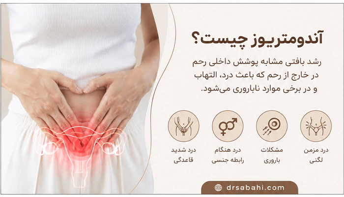آندومتریوز چیست