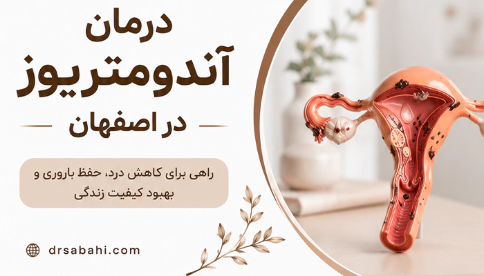 درمان آندومتریوز در اصفهان