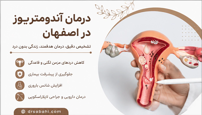 درمان اندومتریوز