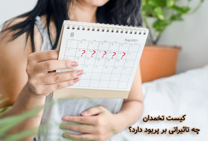 تاثیر کیست تخمدان بر قاعدگی