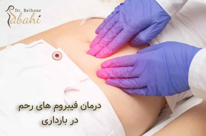 درمان فیبروم های رحم در بارداری