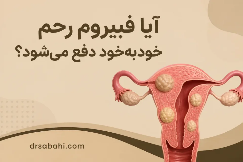 نمای توضیحی درباره چه عواملی ممکن است باعث دفع فیبروم شوند