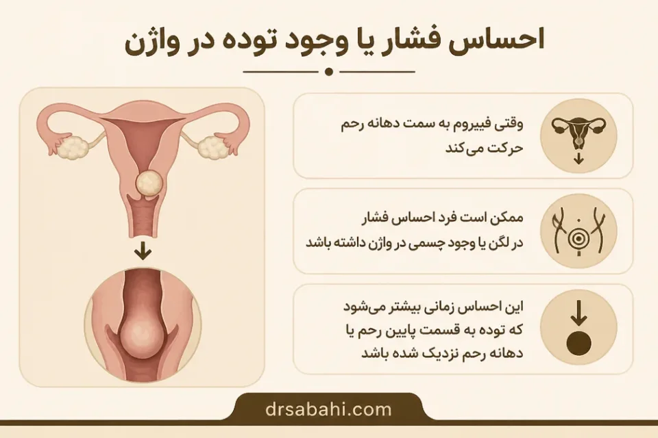 نمای توضیحی درباره احساس فشار یا وجود توده در واژن